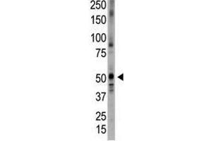 Image no. 1 for anti-Bone Morphogenetic Protein 5 (BMP5) (N-Term) antibody (ABIN357183)