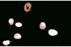 Immunofluorescent staining of Human Endothelial cells. (MCM2 anticorps  (AA 725-888))