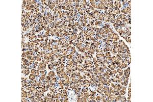 IHC analysis of RPN2 using anti-RPN2 antibody (ABIN7602211).