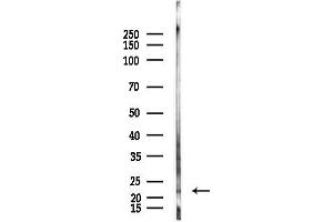 anti-Crystallin, beta A4 (CRYbA4) antibody