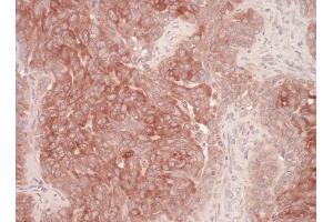 Immunohistochemistry (IHC) image for anti-Der1-Like Domain Family, Member 1 (DERL1) (AA 201-251) antibody (ABIN7453690)