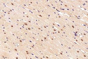Immunohistochemistry analysis of paraffin-embedded rat heart using,NOS1AP (ABIN7074844) at dilution of 1: 4000 (NOS1AP anticorps)