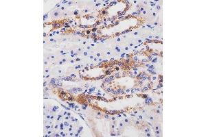 (ABIN6244111 and ABIN6577256) staining ME2 in human kidney tissue sections by Immunohistochemistry (IHC-P - paraformaldehyde-fixed, paraffin-embedded sections).