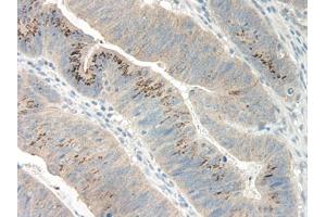 Image no. 1 for anti-Growth Regulated Oncogene gamma (GRO gamma) antibody (ABIN465908) (GRO gamma anticorps)