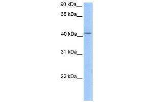 HMBS antibody used at 1 ug/ml to detect target protein. (HMBS anticorps  (Middle Region))