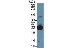 Western Blot; Sample: Mouse Liver lysate; Primary Ab: 2µg/ml Rabbit Anti-Mouse PRDX1 Antibody Second Ab: 0. (Peroxiredoxin 1 anticorps  (AA 1-199))