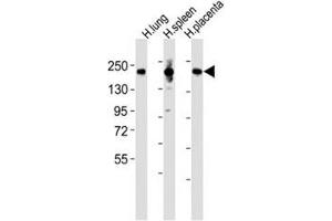 Western blot testing of MRC1L1 antibody at 1:2000 dilution and human samples: Lane 1: lung lysate (Macrophage Mannose Receptor 1 anticorps  (AA 359-388))