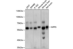 Western blot analysis of extracts of various cell lines, using MPP6 antibody (ABIN6132328, ABIN6143972, ABIN6143973 and ABIN6214790) at 1:1000 dilution. (MPP6 anticorps  (AA 220-420))
