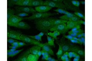 Immunofluorescent staining of SK-N-SH cells (right). (Glucocorticoid Receptor anticorps  (AA 176-289))