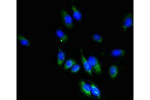 Immunofluorescent analysis of Hela cells using ABIN7171842 at dilution of 1:100 and Alexa Fluor 488-congugated AffiniPure Goat Anti-Rabbit IgG(H+L) (TSPAN1 anticorps  (AA 110-211))