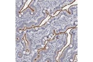 Immunohistochemical staining of human duodenum with MYO7B polyclonal antibody  shows strong membranous positivity in glandular cells at 1:20-1:50 dilution. (Myosin VIIB anticorps)