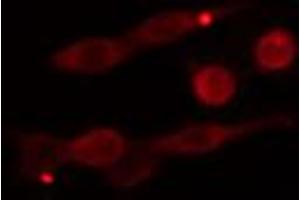 ABIN6274280 staining Hela cells by IF/ICC. (DGKE anticorps  (Internal Region))