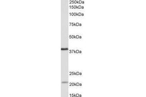Image no. 1 for anti-Kelch Domain Containing 8B (KLHDC8B) (AA 259-270) antibody (ABIN1102756) (KLHDC8B anticorps  (AA 259-270))