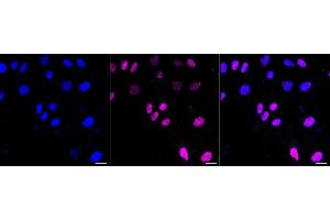 anti-MEF2A+MEF2C antibody
