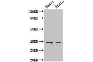 Western Blot Positive WB detected in: Mouse heart tissue, Mouse brain tissue All lanes: CDK5 antibody at 4 μg/mL Secondary Goat polyclonal to rabbit IgG at 1/50000 dilution Predicted band size: 34, 30 kDa Observed band size: 34 kDa (CDK5 anticorps  (AA 1-292))
