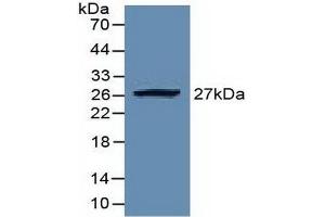 Detection of Recombinant EZH2, Human using Polyclonal Antibody to Enhancer Of Zeste Homolog 2 (EZH2) (EZH2 anticorps  (AA 51-285))