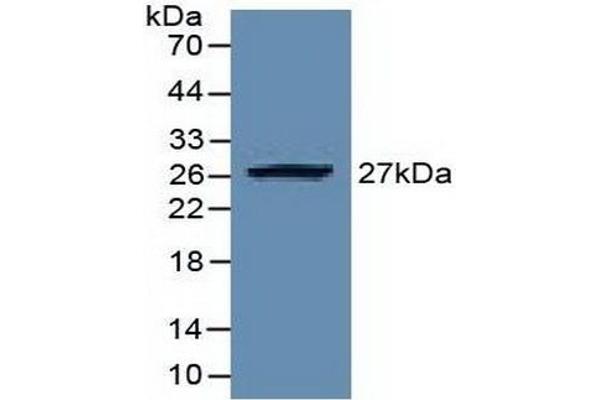 EZH2 anticorps  (AA 51-285)