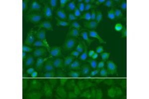 anti-Synovial Sarcoma, X Breakpoint 5 (SSX5) antibody