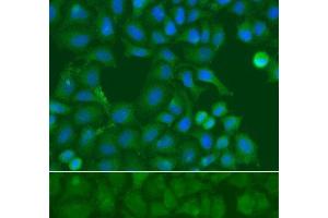 Immunofluorescence analysis of A549 cells using SSX5 Polyclonal Antibody (SSX5 anticorps)