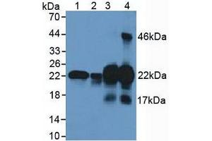 Figure. (CSRP1 anticorps  (AA 1-193))