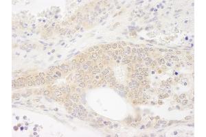 Immunohistochemistry (IHC) image for anti-DEAD (Asp-Glu-Ala-As) Box Polypeptide 19B (DDX19B) (C-Term) antibody (ABIN7448514) (DDX19B anticorps  (C-Term))