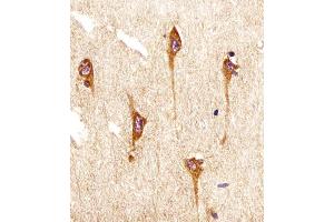 (ABIN6242493 and ABIN6577096) staining NTRK2 in human brain sections by Immunohistochemistry (IHC-P - paraformaldehyde-fixed, paraffin-embedded sections).