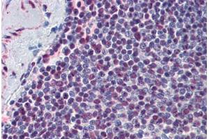 Human Spleen: Formalin-Fixed, Paraffin-Embedded (FFPE) (p300 anticorps  (AA 731-831))