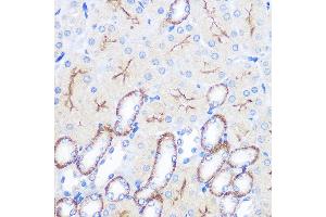 Immunohistochemistry of paraffin-embedded mouse kidney using CD64 Rabbit pAb (ABIN3021694, ABIN3021695, ABIN3021696 and ABIN6215530) at dilution of 1:100 (40x lens).