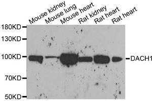 Western blot analysis of extracts of various cell lines, using DACH1 antibody. (DACH1 anticorps)