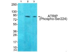 Western blot analysis of extracts from 293 cells (Lane 2) and Hela cells (Lane 3), using ATRIP (Phospho-Ser224) Antibody. (ATRIP anticorps  (pSer224))