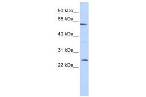 Western Blotting (WB) image for anti-Solute Carrier Family 18 (Vesicular Monoamine Transporter), Member 1 (SLC18A1) antibody (ABIN2458160) (SLC18A1 anticorps)