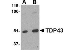 Western blot analysis of TDP43 in L1210 cell lysate with this product at (A) 0. (TARDBP anticorps  (Center))