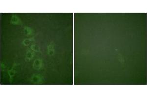 Immunofluorescence analysis of HuvEc cells, using Histamine H1 Receptor (Phospho-Ser398) Antibody. (HRH1 anticorps  (pSer398))