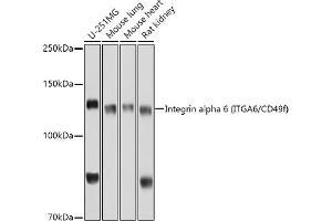 Western blot analysis of extracts of various cell lines, using Integrin alpha 6 (ITG/CD49f) antibody (ABIN6129395, ABIN6142566, ABIN6142567 and ABIN6220169) at 1:1000 dilution. (ITGA6 anticorps  (AA 870-1010))