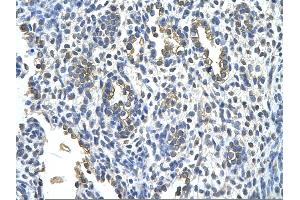 Rabbit Anti-KRT2 Antibody       Paraffin Embedded Tissue:  Human alveolar cell   Cellular Data:  Epithelial cells of renal tubule  Antibody Concentration:   4.