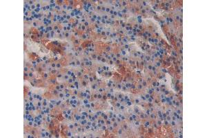 Used in DAB staining on fromalin fixed paraffin- embedded Kidney tissue (MTUS1 anticorps  (AA 1020-1210))