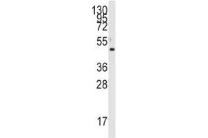 Western blot analysis of PDK4 antibody and HL-60 lysate.