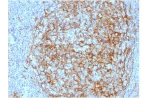 ABIN6383875 to CD14 was successfully used to stain membranes of macrophages in human lymph node and tonsil sections. (CD14 anticorps  (Extracellular Domain))