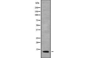 Western blot analysis NDUFB3 using LOVO whole cell lysates
