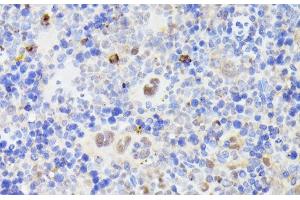 Immunohistochemistry of paraffin-embedded Mouse spleen using MLF2 Polyclonal Antibody at dilution of 1:100 (40x lens). (MLF2 anticorps)