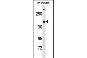 SET1B Antibody (C-term) (ABIN656346 and ABIN2845645) western blot analysis in mouse heart tissue lysates (35 μg/lane). (SETD1B anticorps  (C-Term))
