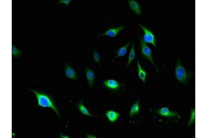 Immunofluorescent analysis of U251 cells using ABIN7143570 at dilution of 1:100 and Alexa Fluor 488-congugated AffiniPure Goat Anti-Rabbit IgG(H+L)