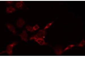 ABIN6278623 staining HepG2 by IF/ICC. (PSCA anticorps)