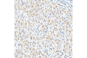 Immunohistochemistry of paraffin-embedded rat ovary using MTAP Rabbit pAb (ABIN6132365, ABIN6144119, ABIN6144120 and ABIN6214763) at dilution of 1:50 (40x lens). (MTAP anticorps  (AA 1-283))