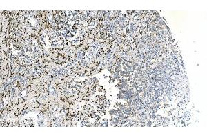 IHC analysis of Coronin 1a/TACO/CORO1A using anti-Coronin 1a/TACO/CORO1A antibody (ABIN7600292).