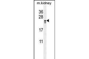 PIGX Antibody (N-term) (ABIN654478 and ABIN2844213) western blot analysis in mouse kidney tissue lysates (35 μg/lane).