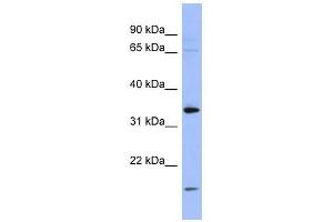 PYCR1 antibody used at 1 ug/ml to detect target protein. (PYCR1 anticorps  (Middle Region))