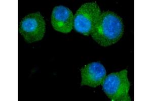 IF analysis of S100A9 using anti-S100A9 antibody (ABIN3042482). (S100A9 anticorps  (AA 2-113))