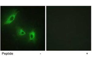 Immunofluorescence analysis of HeLa cells, using ACVR1B polyclonal antibody . (Activin A Receptor Type IB/ALK-4 anticorps  (AA 73-122))
