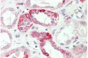 Human Kidney: Formalin-Fixed, Paraffin-Embedded (FFPE)